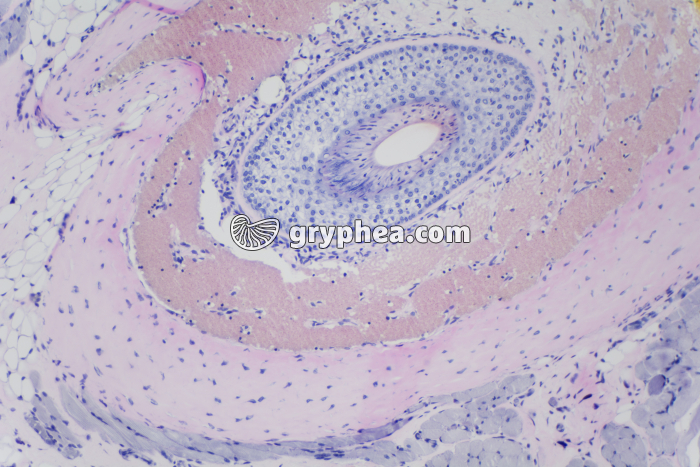 Peau avec glandes sébacées x40 - gryphea.org